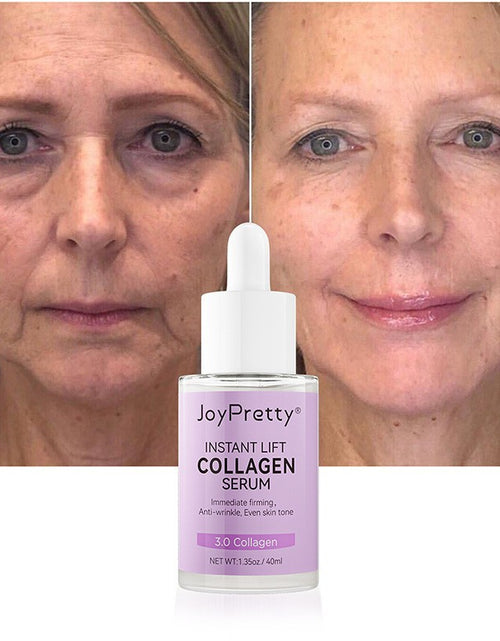 Load image into Gallery viewer, Collagen Serum Moisturizing Hydration Absorption Light Lines
