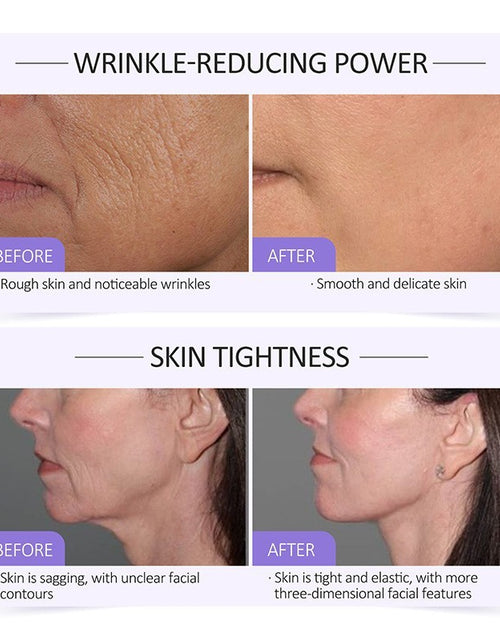 Load image into Gallery viewer, Collagen Serum Moisturizing Hydration Absorption Light Lines
